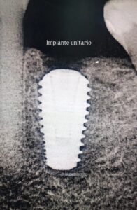 WhatsApp Image 2025-05-21 at 11.09.33 PM (1)