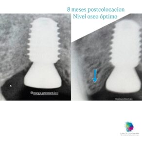 WhatsApp Image 2025-05-21 at 11.09.33 PM