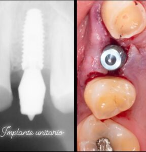 WhatsApp Image 2025-05-21 at 11.09.33 PM (3)