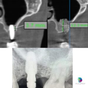 WhatsApp Image 2025-05-21 at 11.11.50 PM