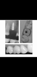 WhatsApp Image 2025-05-21 at 11.13.28 PM (2)