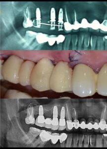 WhatsApp Image 2025-05-21 at 11.21.52 PM