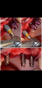 WhatsApp Image 2025-05-21 at 11.22.11 PM