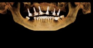 Caso realizado en Esthetic Dental Center