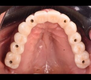 Caso realizado en Esthetic Dental Center